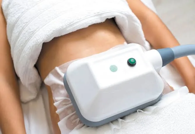 تبريد الدهون (كرايو ليبوليسيس): تنحيف موضعي بالتجميد