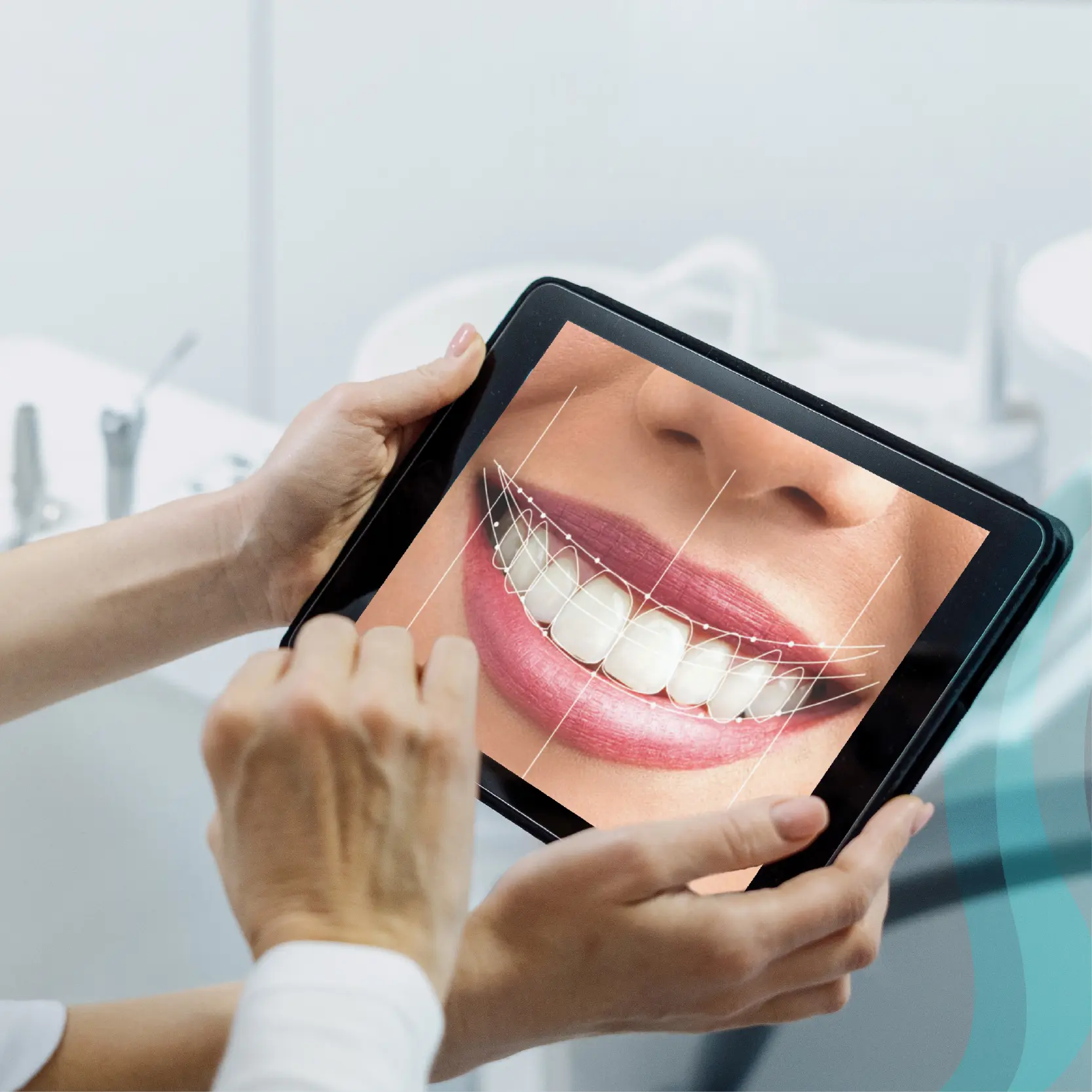تبييض الأسنان بالليزر: ابتسامة أكثر إشراقًا خلال جلسة واحدة
