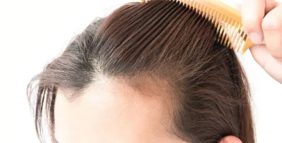 ما أسباب تساقط الشعر عند النساء وكيف تتعاملين معه؟