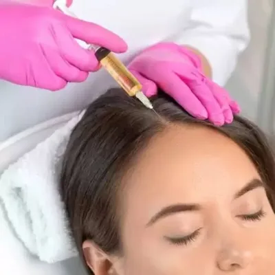 كيف تساعد البلازما (PRP) في تكثيف الشعر؟